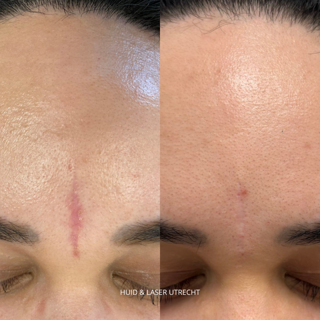 Before & After foto-4