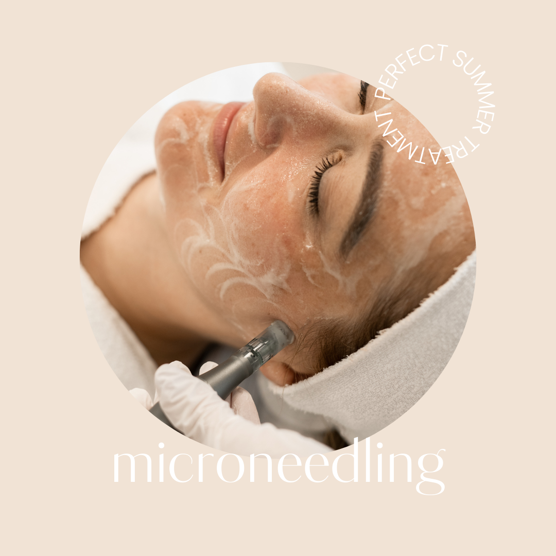 microneedling