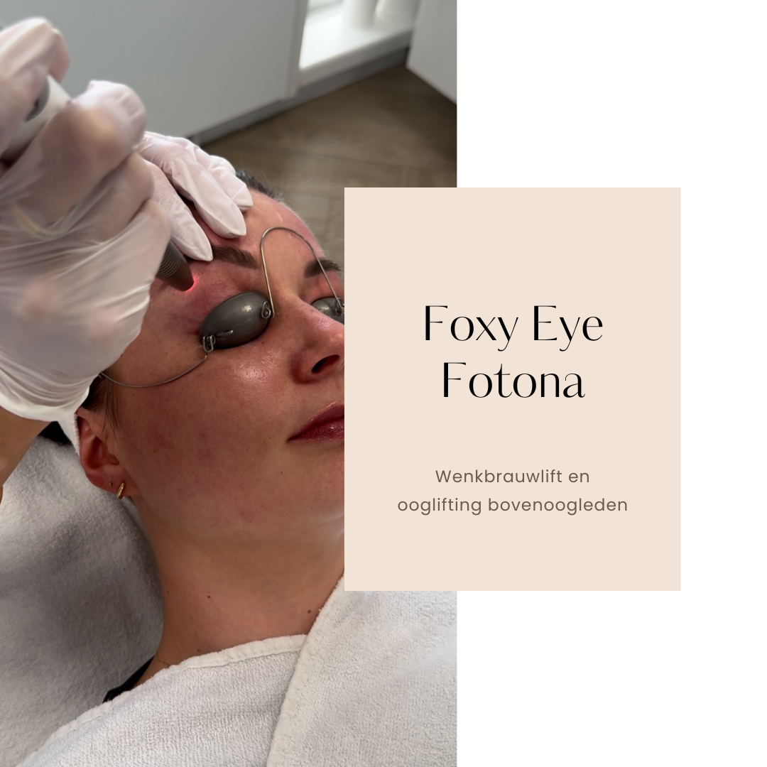 Foxy Eye behandeling