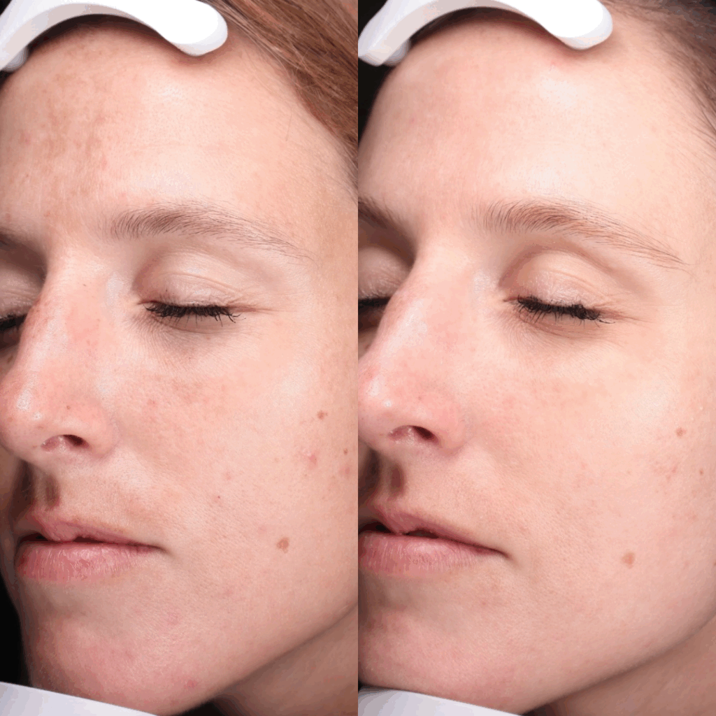 Before & After foto-3