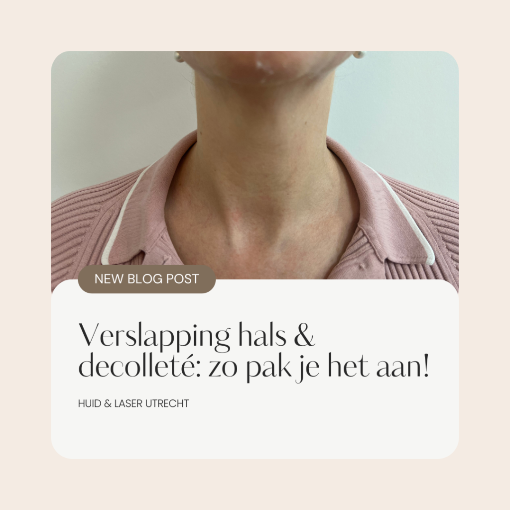 Verslapping hals en decolleté